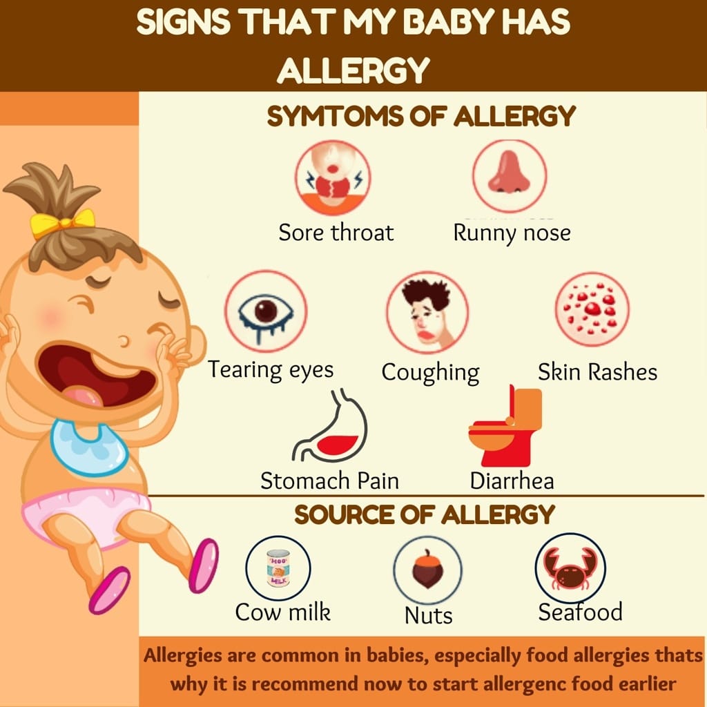 How to relieve food allergy symptoms